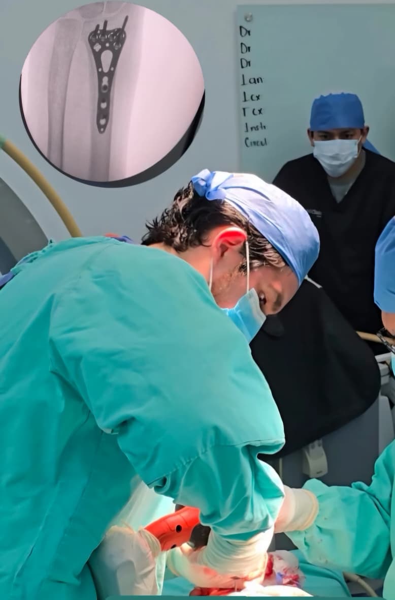 Cirugía de fracturas con fijación ortopédica