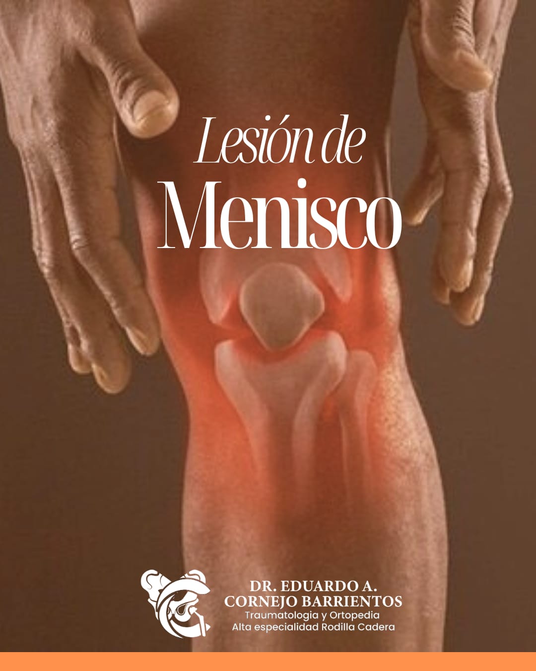 Lesión de menisco de rodilla